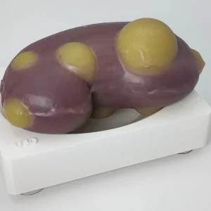 Kit de formación en nefrectomía parcial